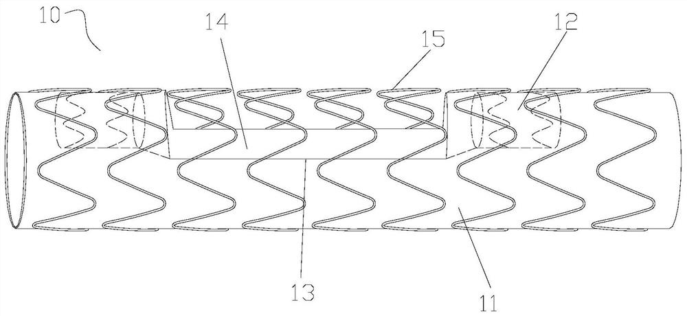 Covered stent