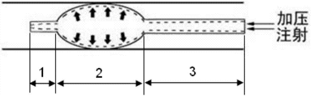 Vascular intervention injection catheter capable of preventing error thrombosis caused by reflux and backflow