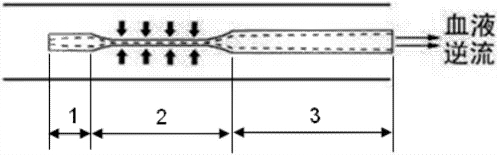 Vascular intervention injection catheter capable of preventing error thrombosis caused by reflux and backflow