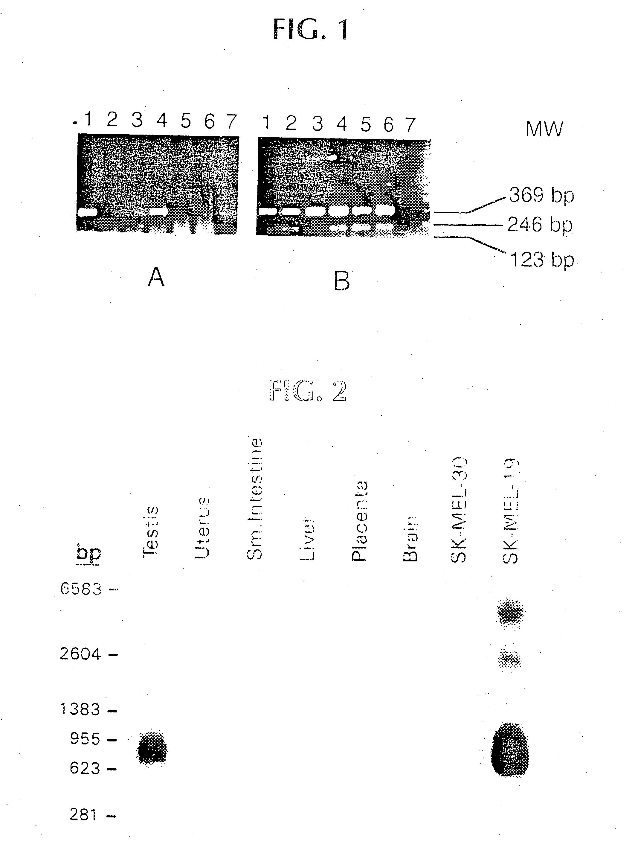 Isolated peptides corresponding to amino acid requirements of NY-ESO-1, which bind to MHC Class I and MHC Class II molecules, and uses thereof