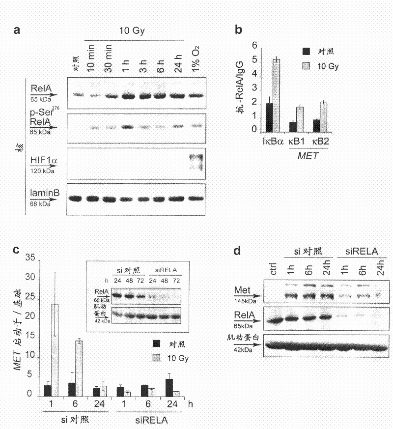 MET inhibitors for enhancing radiotherapy efficacy