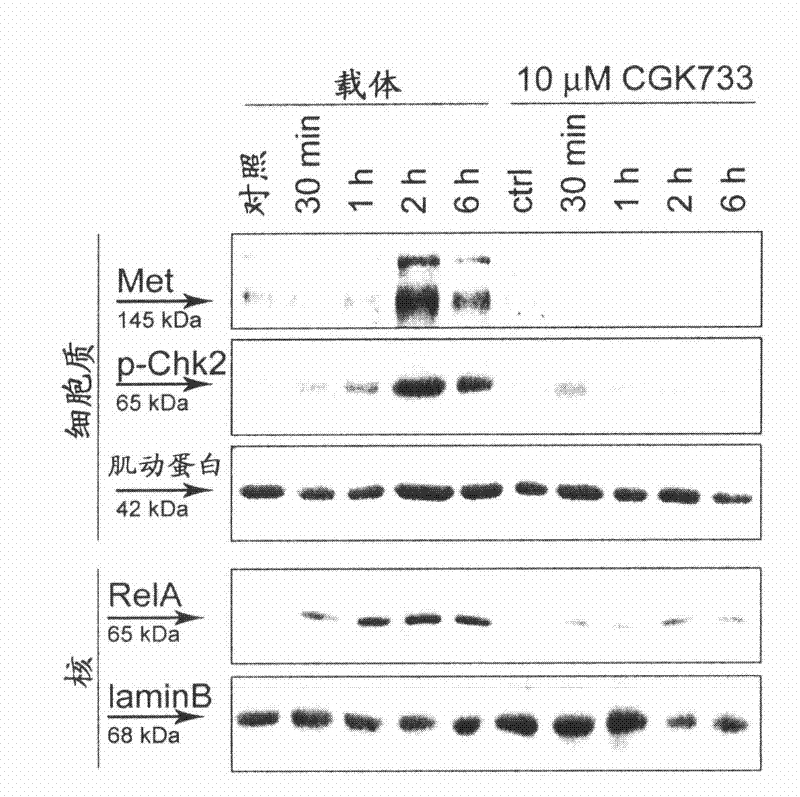 MET inhibitors for enhancing radiotherapy efficacy