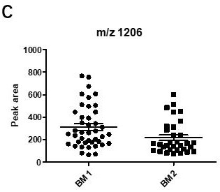 Application of urine protein delta homolog 1 and polypeptide fragment thereof in gestational diabetes mellitus