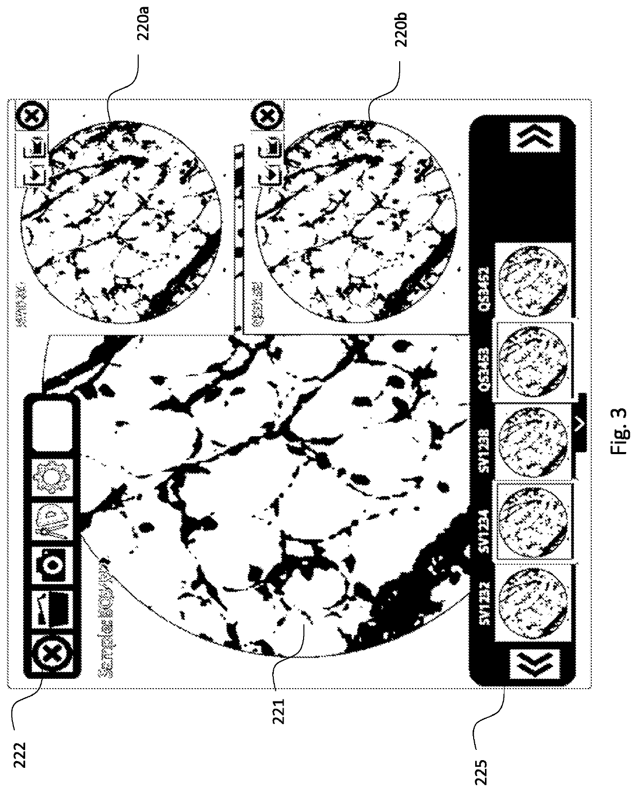 A system for histological examination of tissue specimens