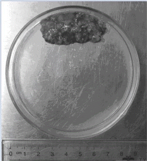 Rapid extraction method of fibroblast and application