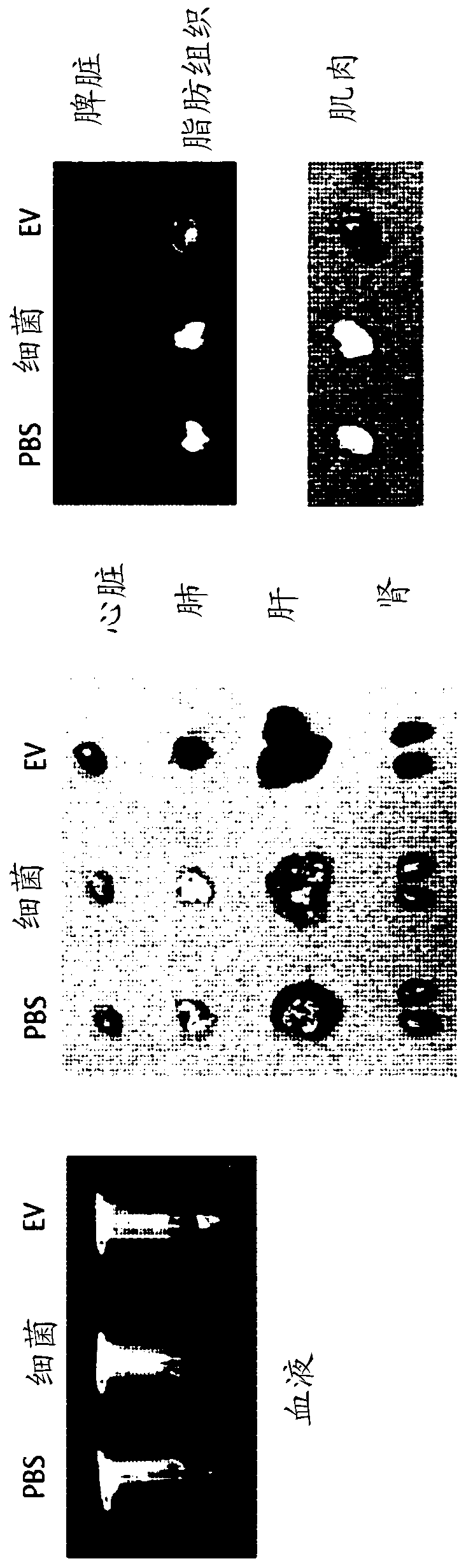 Nanovesicles derived from faecalibacterium prausnitzii, and uses thereof