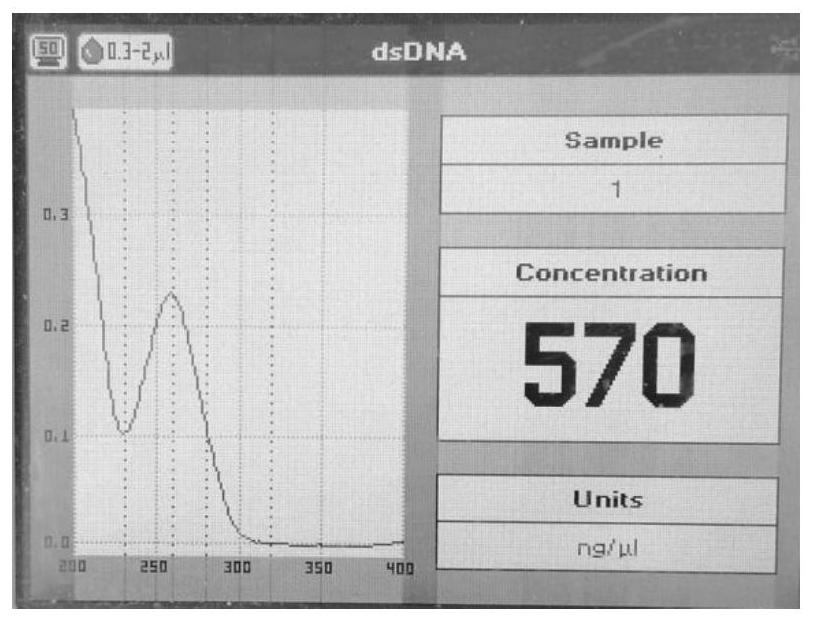 DNA extracting solution and method for extracting DNA of gram-positive bacteria