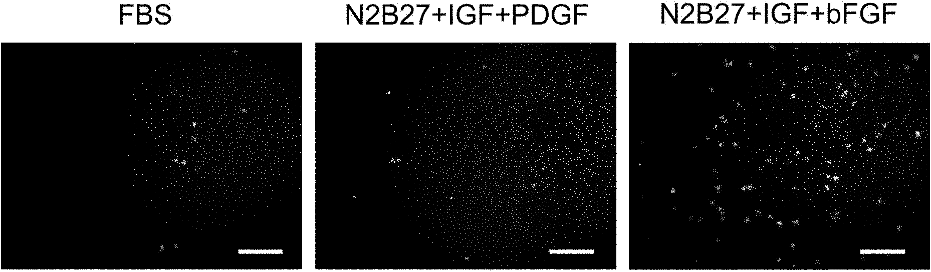 Pretreatment method for improving migration capability of mesenchymal stem cells