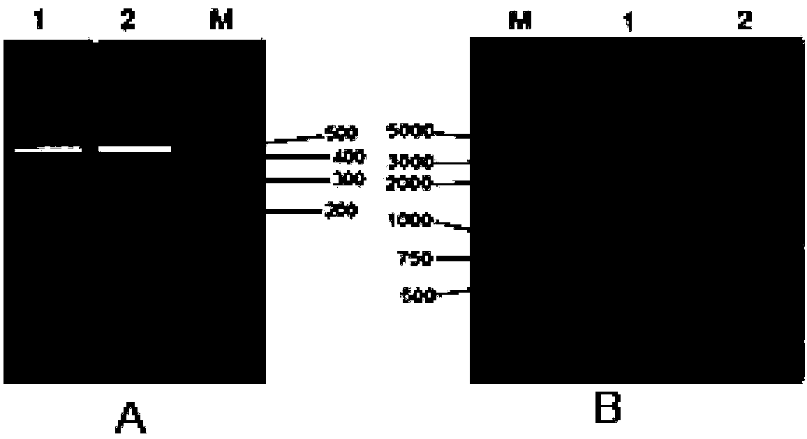 Preparation and application of recombinant yeast preparation for co-expression of porcine interleukin 4/6 and fusion porcine antibacterial peptide