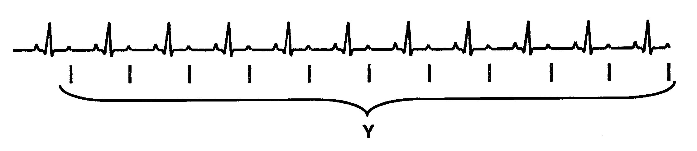 Ultrasound triggering method