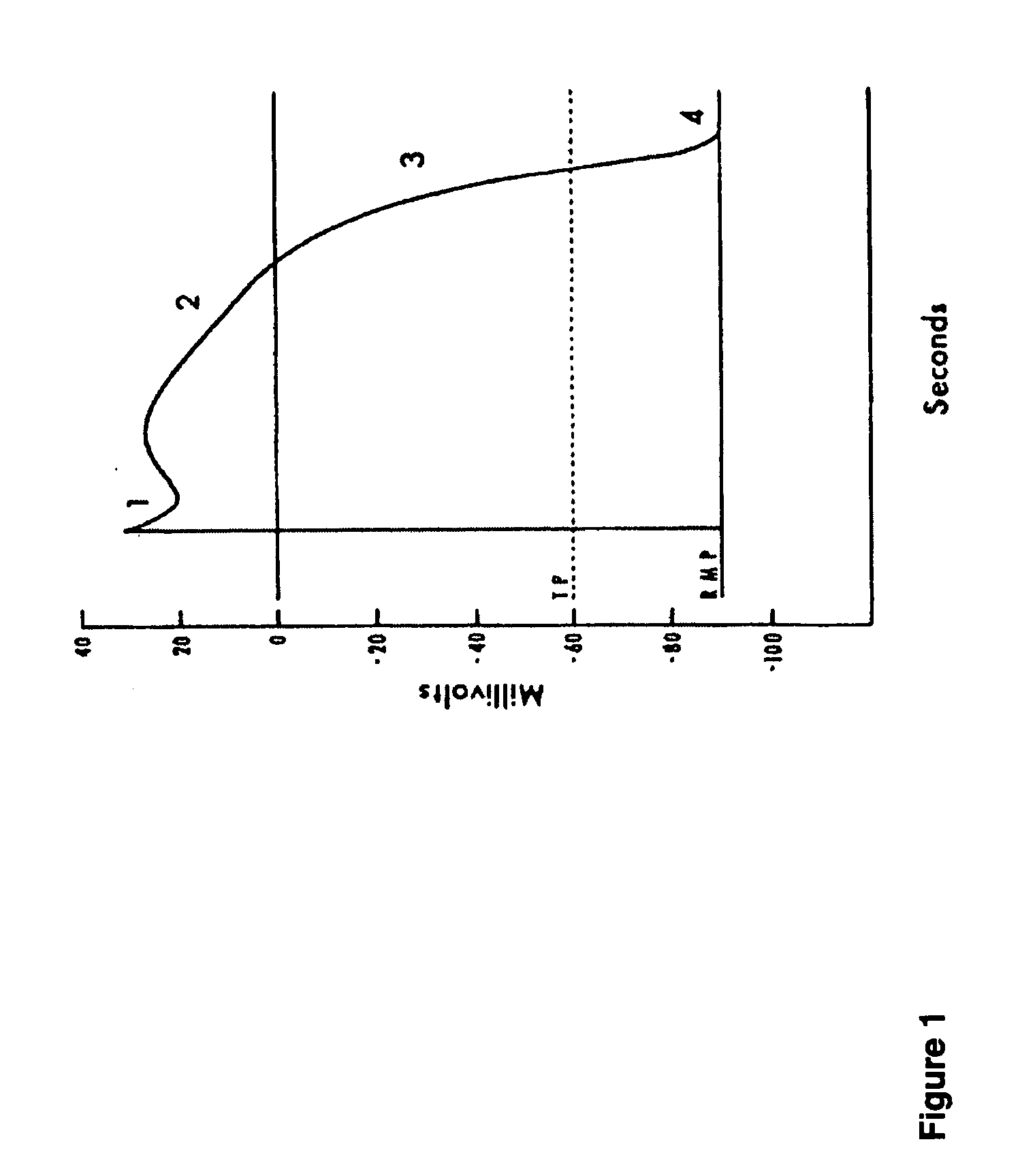 Ultrasound triggering method