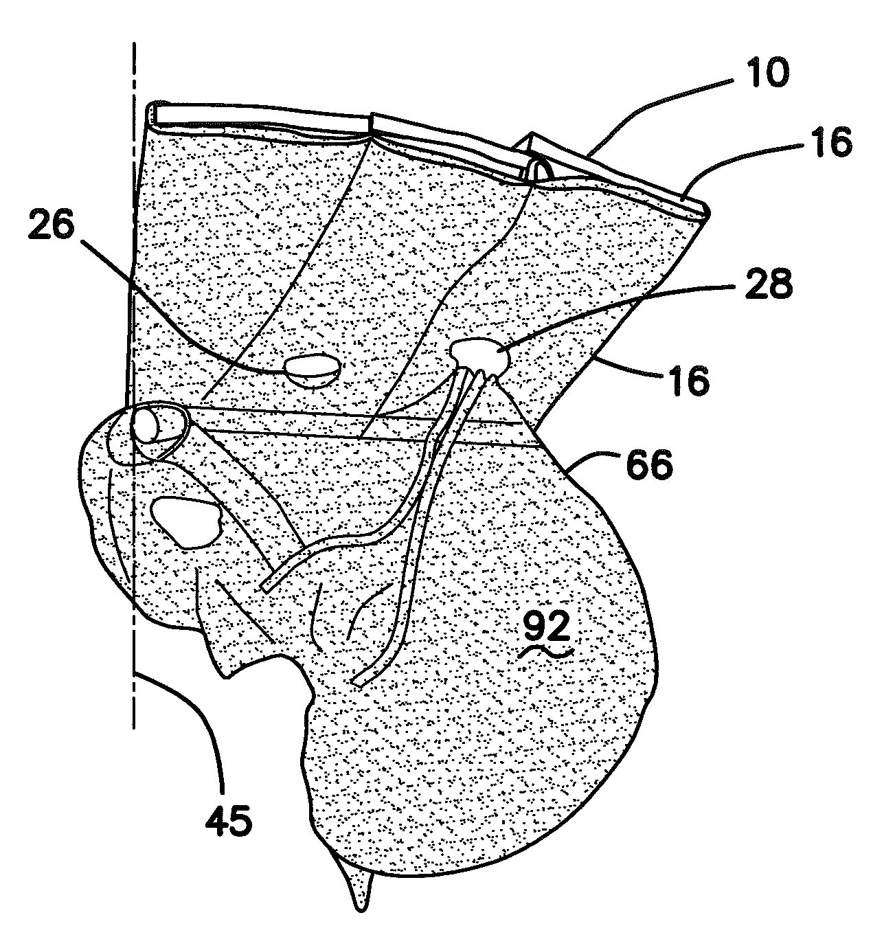 Hernia model