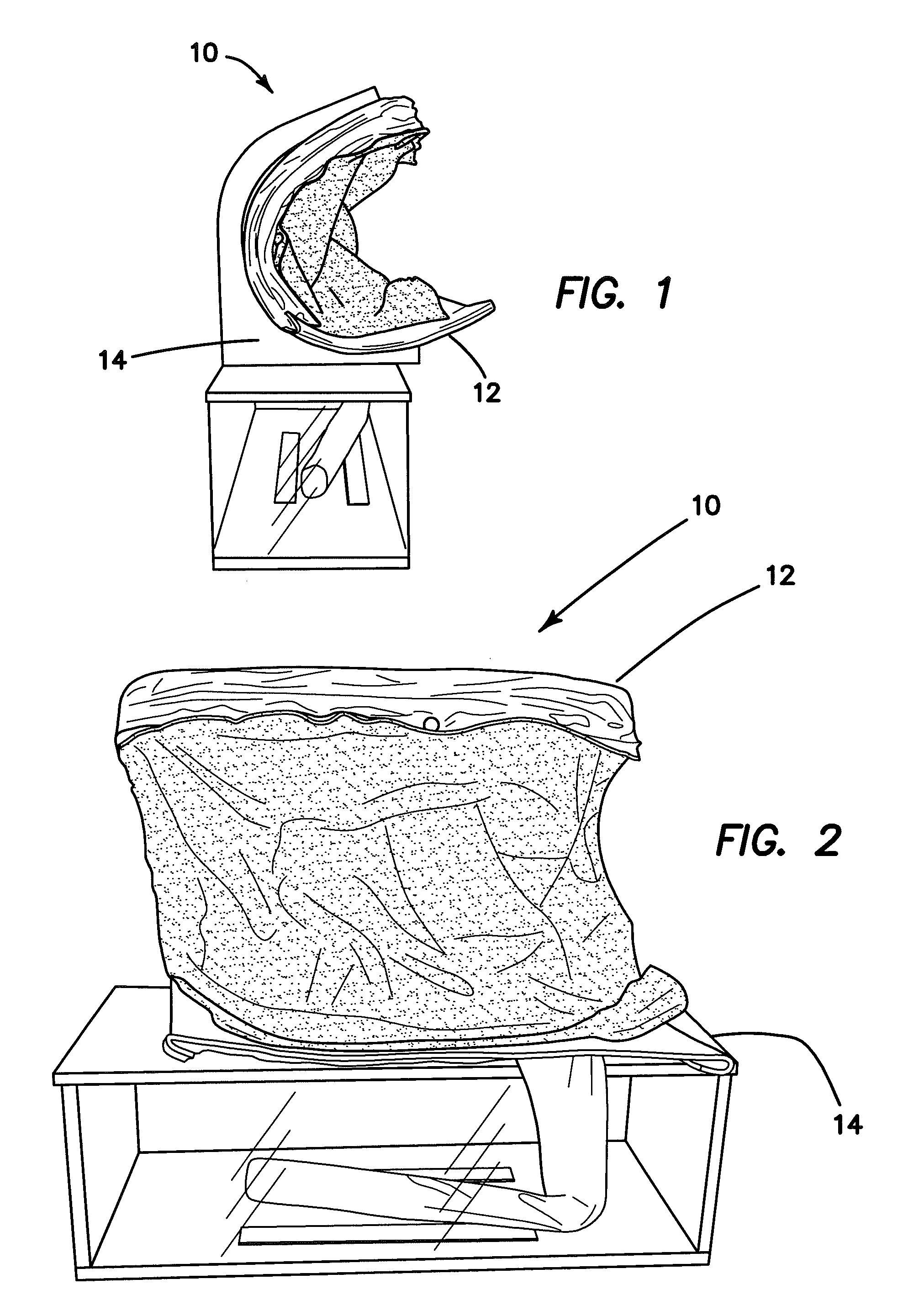 Hernia model