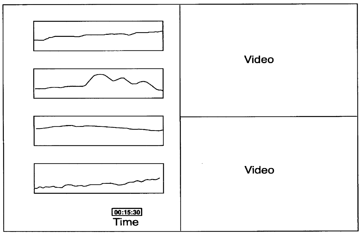 Method for visually integrating multiple data acquisition technologies for real time and retrospective analysis