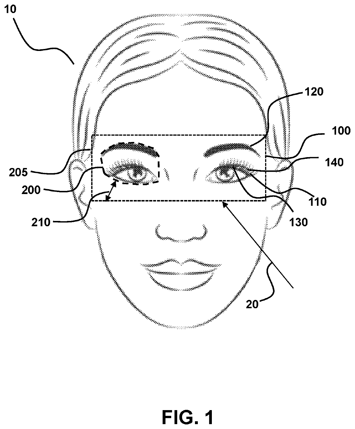 Treatment of ophthalmological conditions with acetylcholinesterase inhibitors