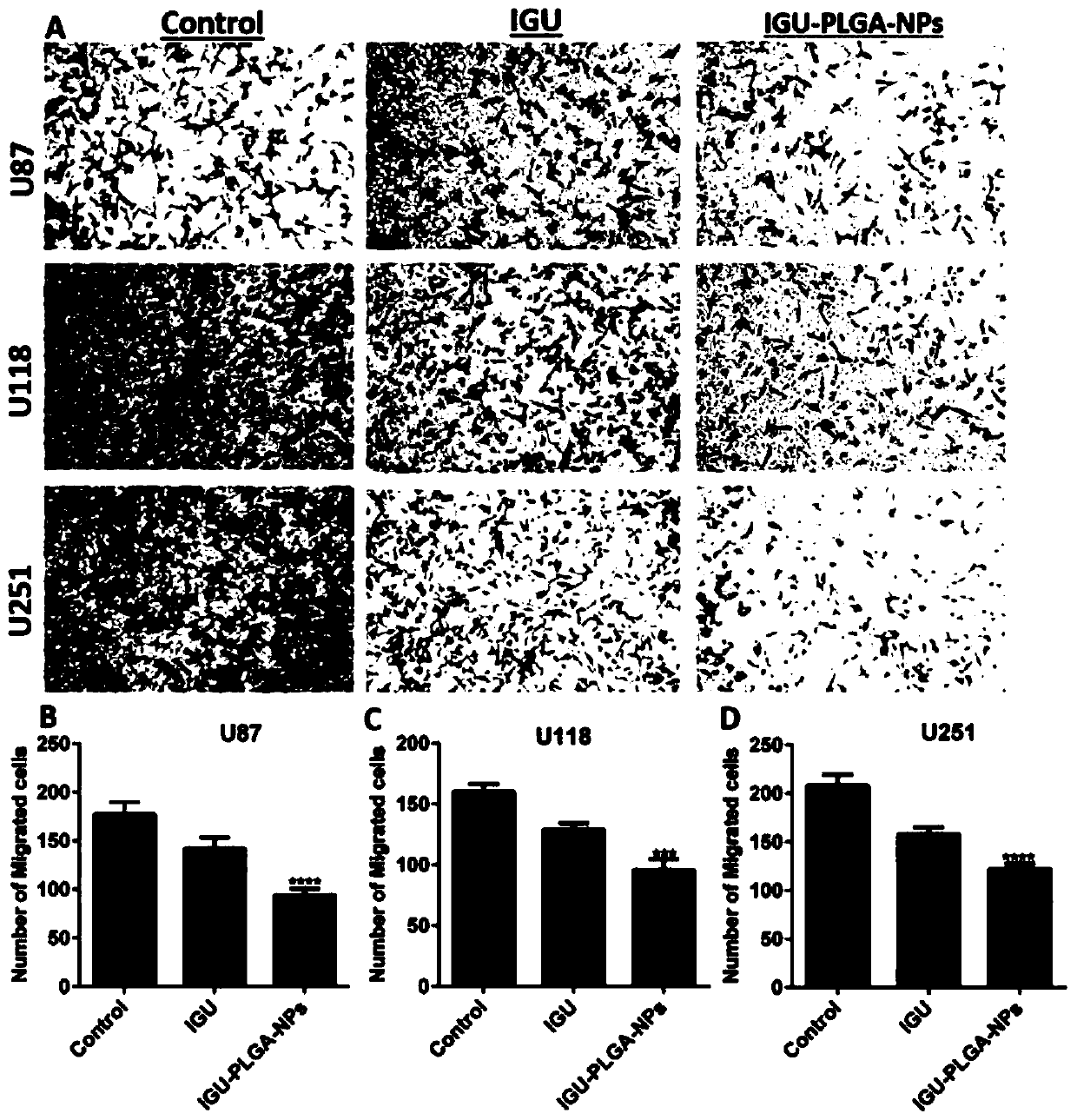 IGU-PLGA-NPs (nanoparticles) and preparation method and application thereof