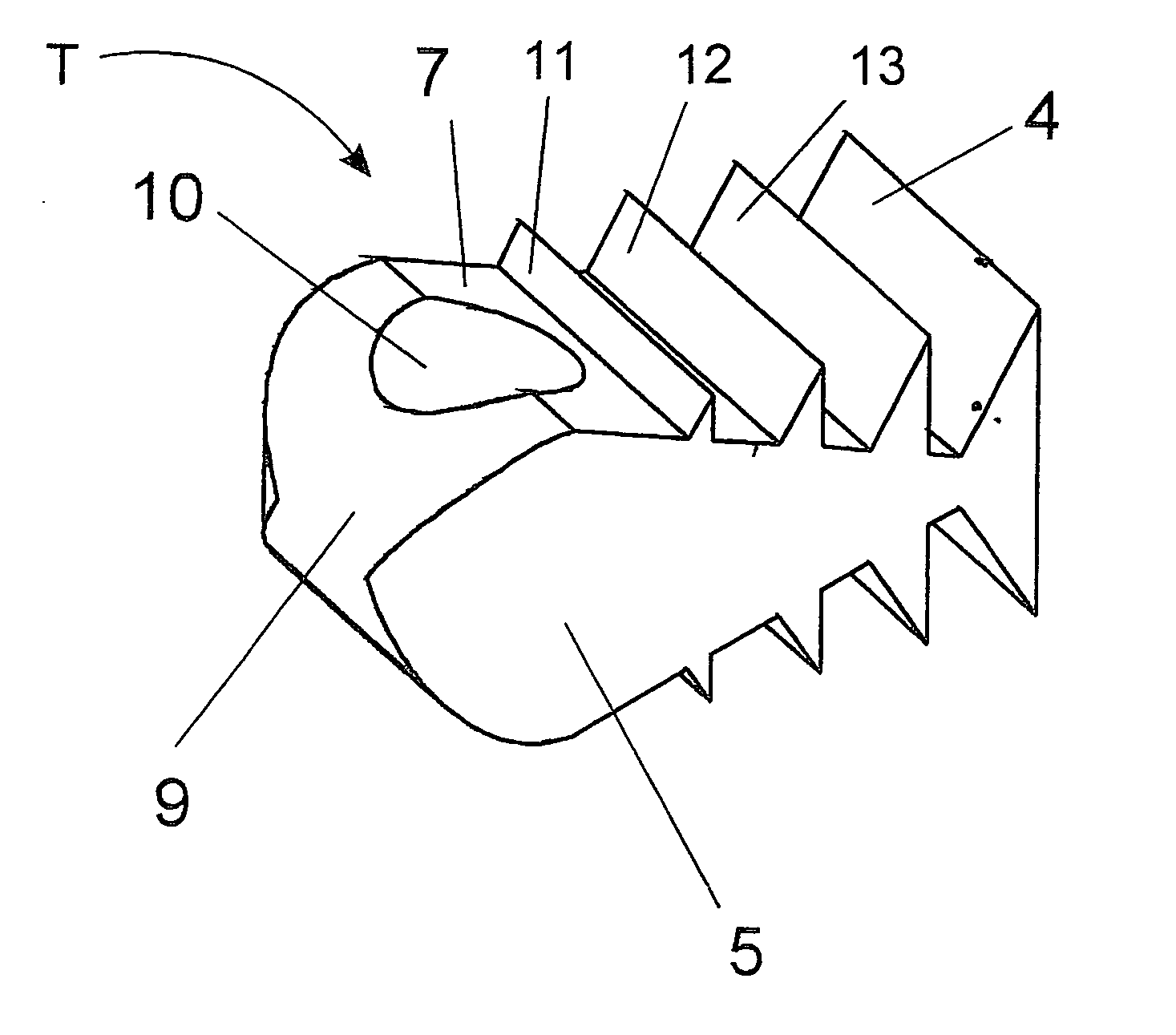 Method for correcting a deformity in the spinal column and its corresponding implant