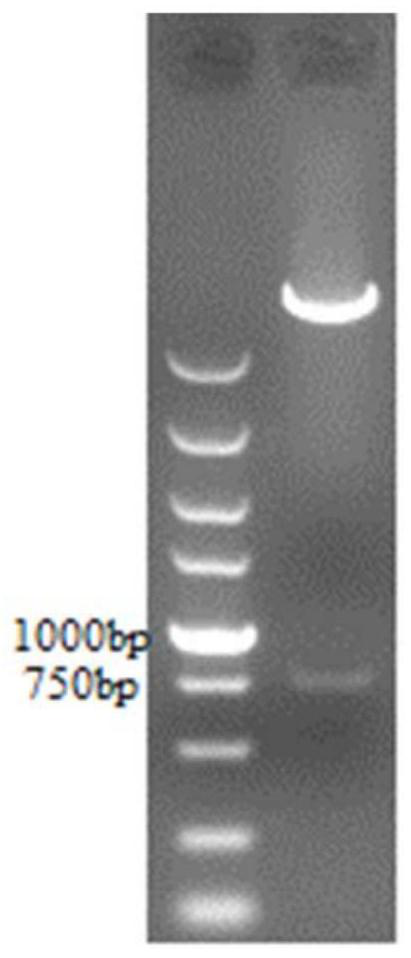 NK trophoblast cell as well as preparation method and application thereof