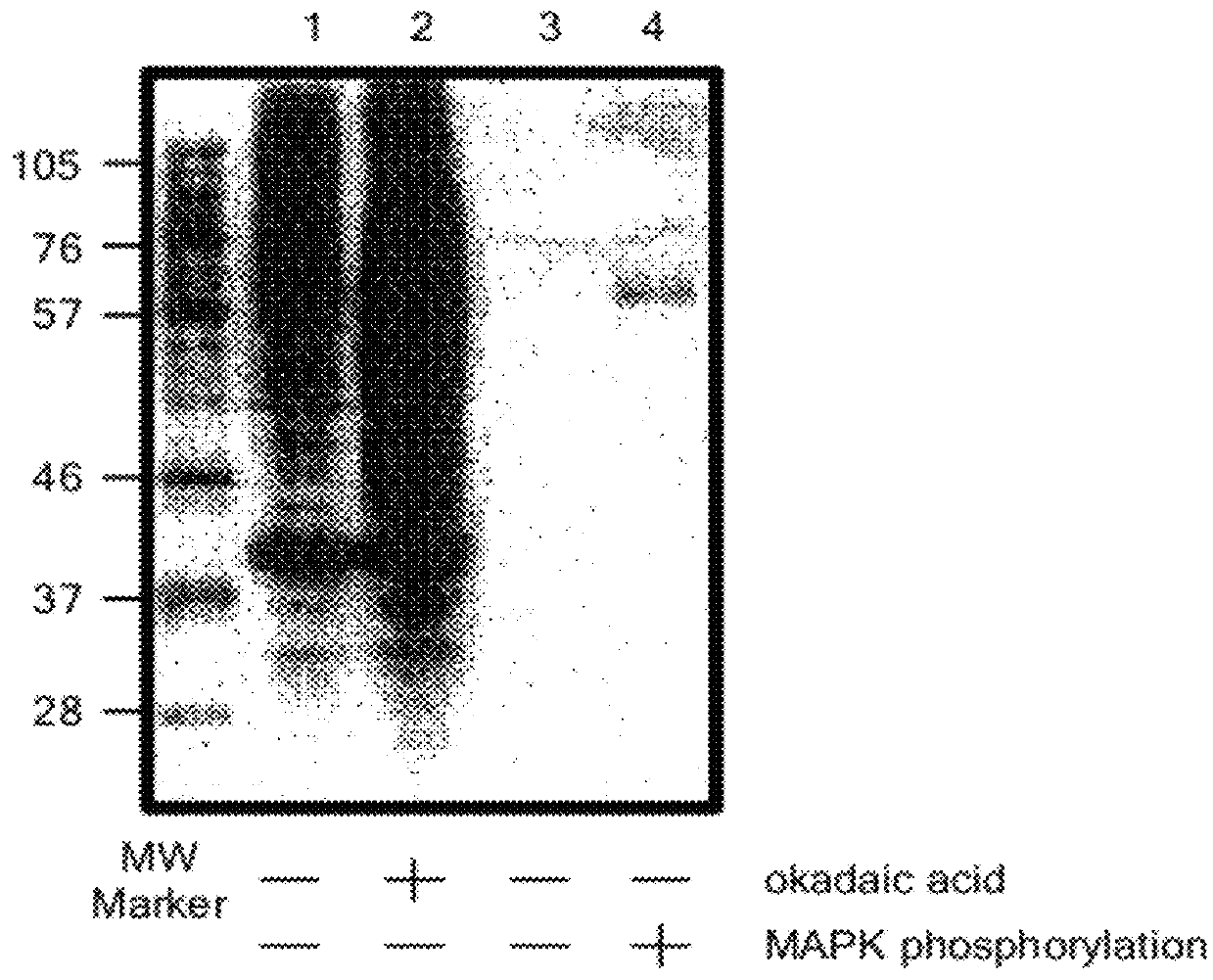 Motif-specific and context-independent antibodies that specifically bind to a cleaved caspase motif