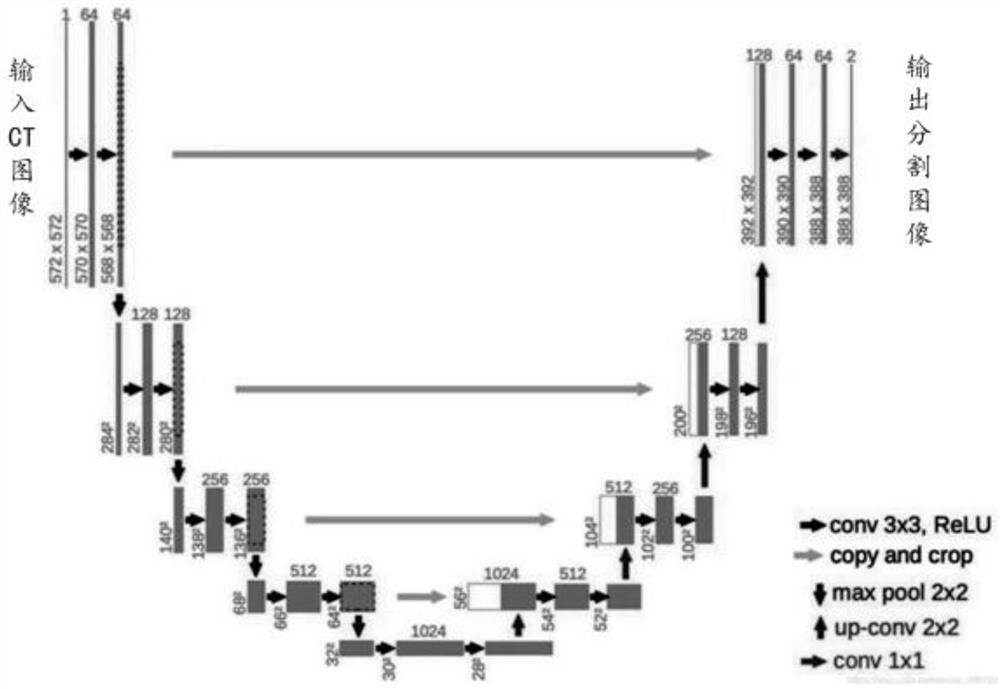 Method, device and system for detecting irradiation dose in human body and computer equipment