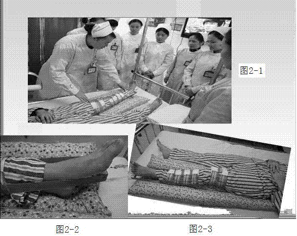 Manufacturing method and application of perforated long pillow for treating femoral neck fracture