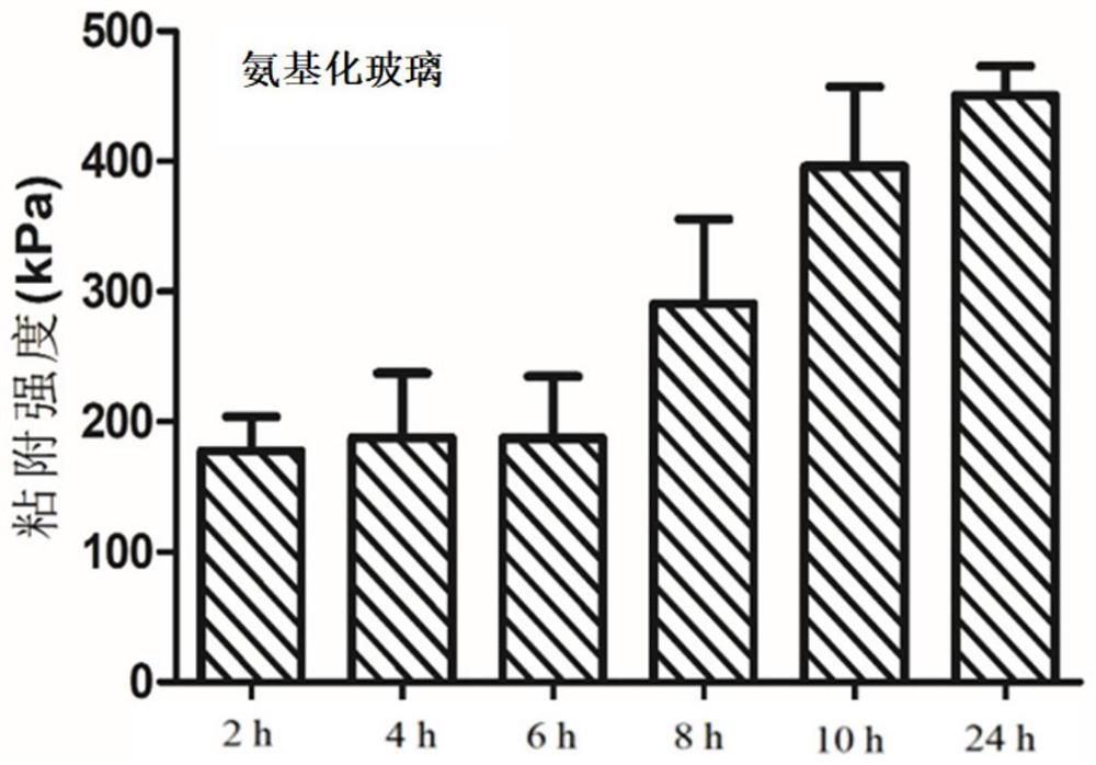 A kind of tissue adhesive and its preparation method and application