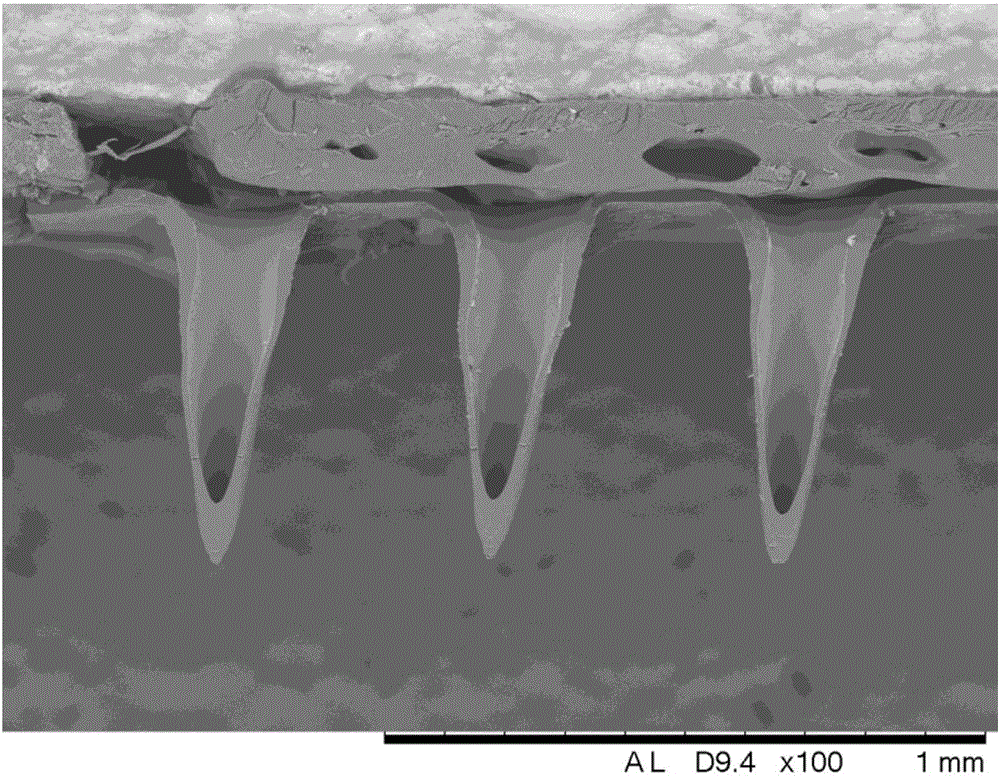 Silk fibroin micro-needle patch and preparation method thereof