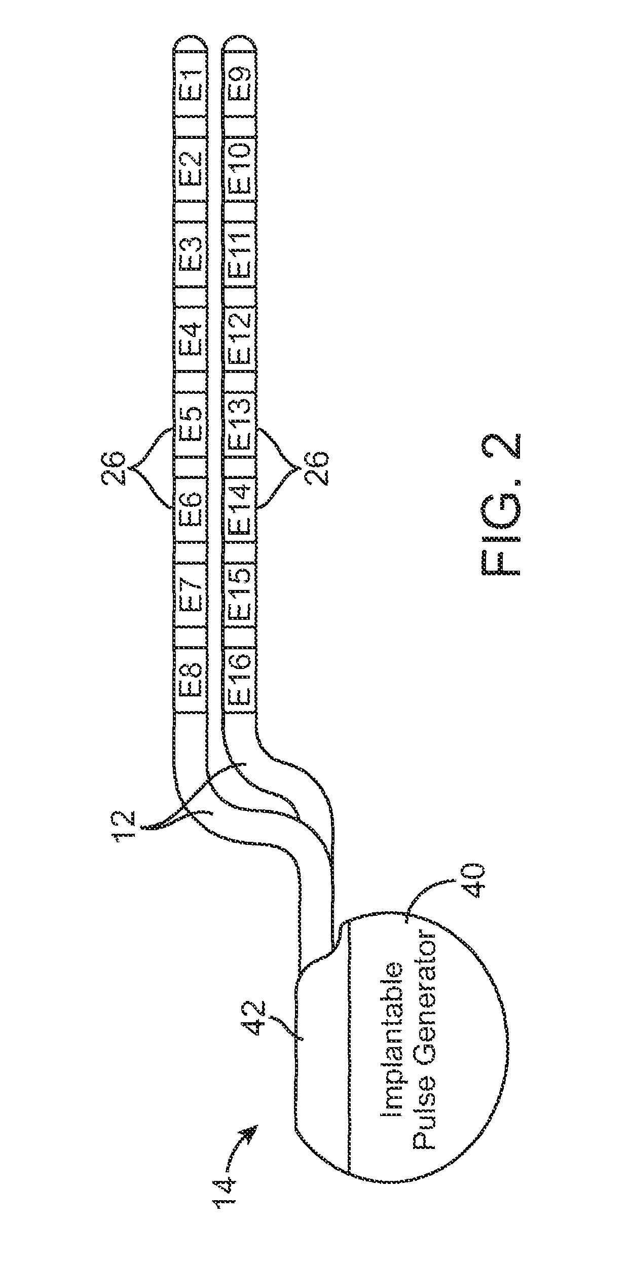 System and method for maintaining a distribution of currents in an electrode array using independent voltage sources