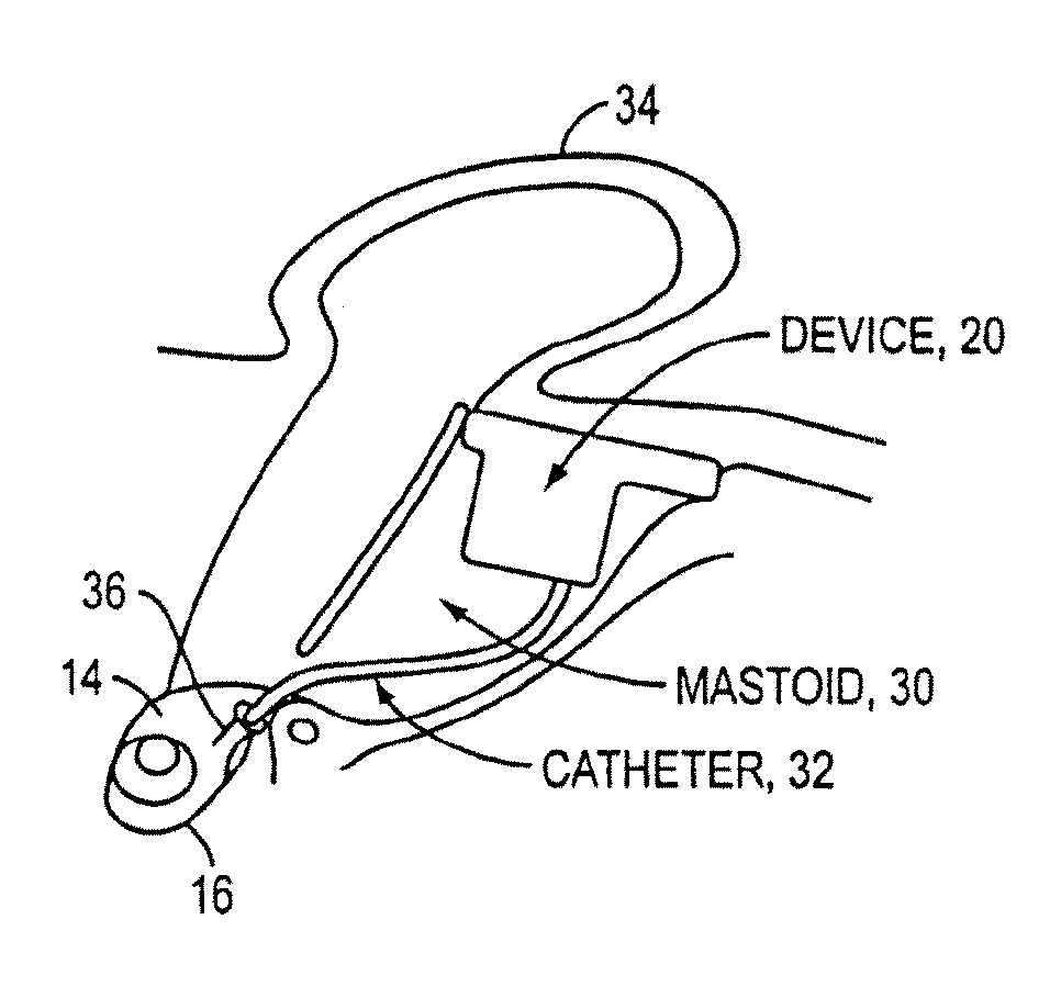 Drug Delivery Apparatus