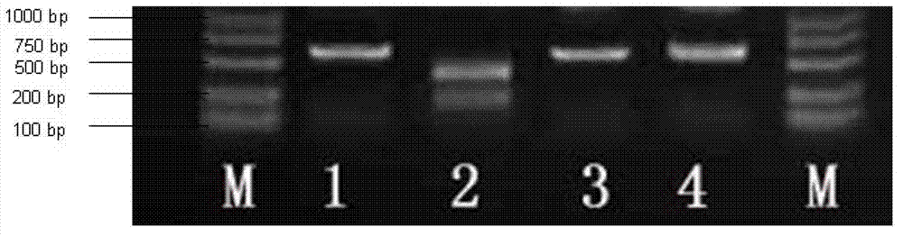 Mutant gene of rice starch branching enzyme SBE3 gene and application of mutant gene