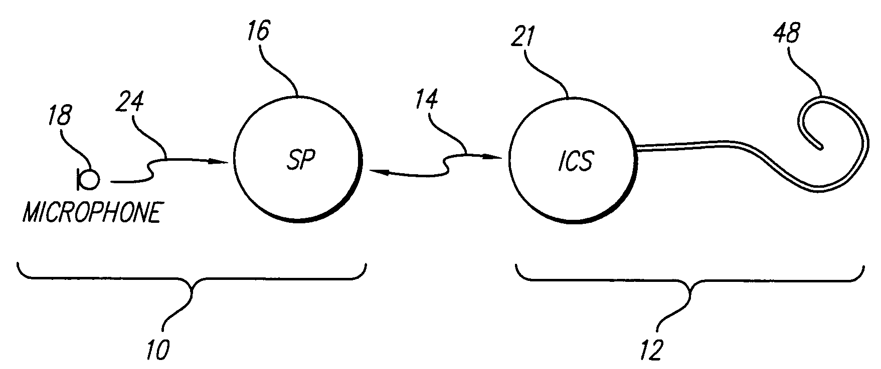 Optimizing pitch and other speech stimuli allocation in a cochlear implant