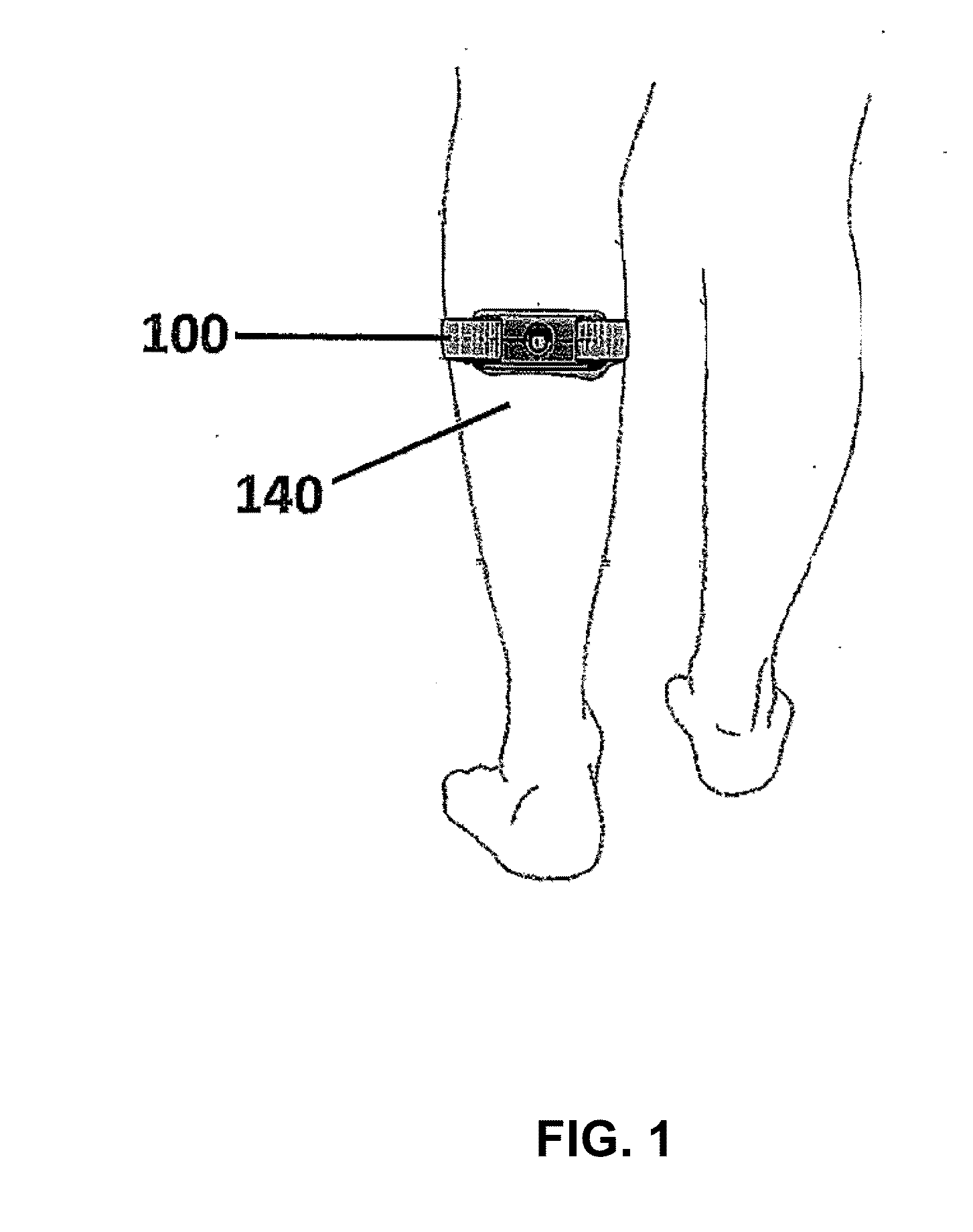 Detecting cutaneous electrode peeling using electrode-skin impedance