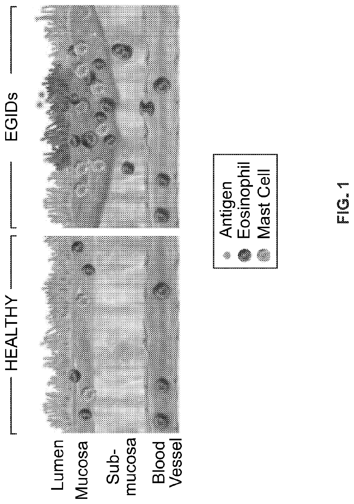 Methods and compositions for treating mast cell gastritis, mast cell esophagitis, mast cell enteritis, mast cell duodenitis, and/or mast cell gastroenteritis