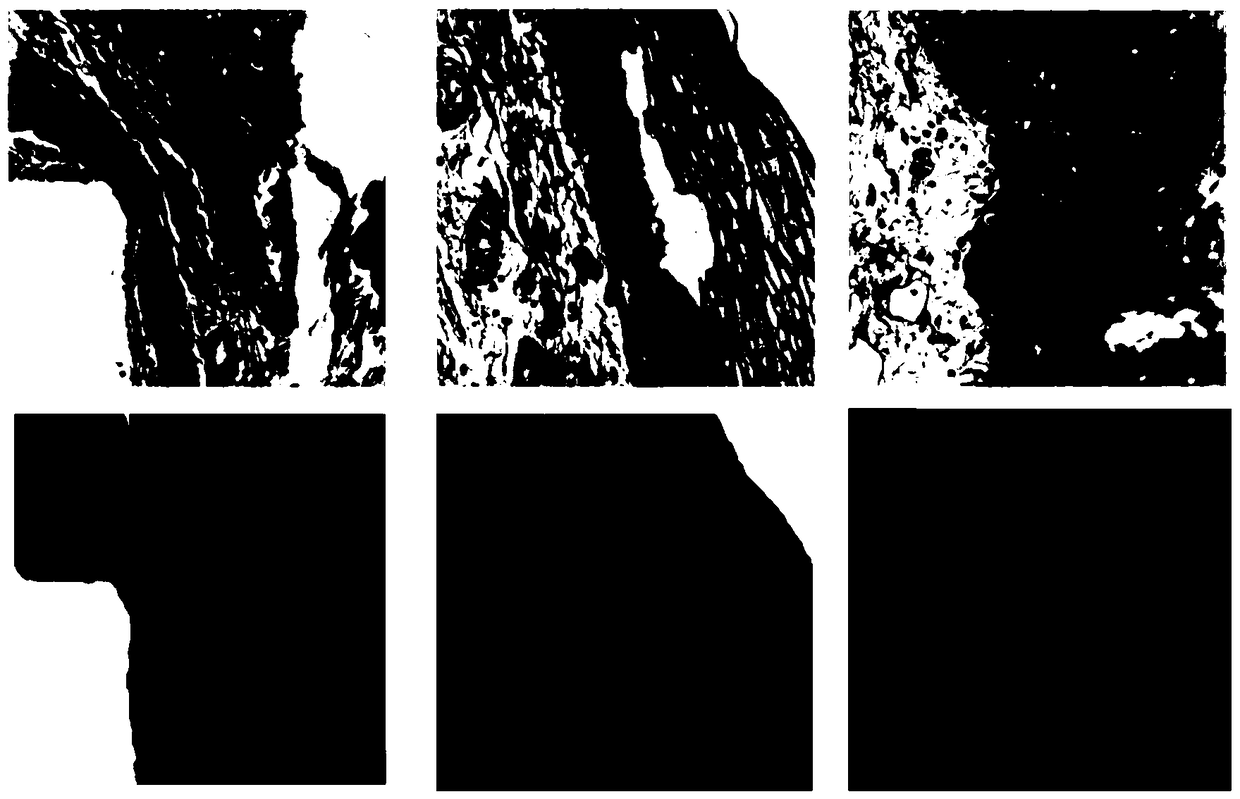 Method for segmenting epithelial tissue in esophageal pathological image