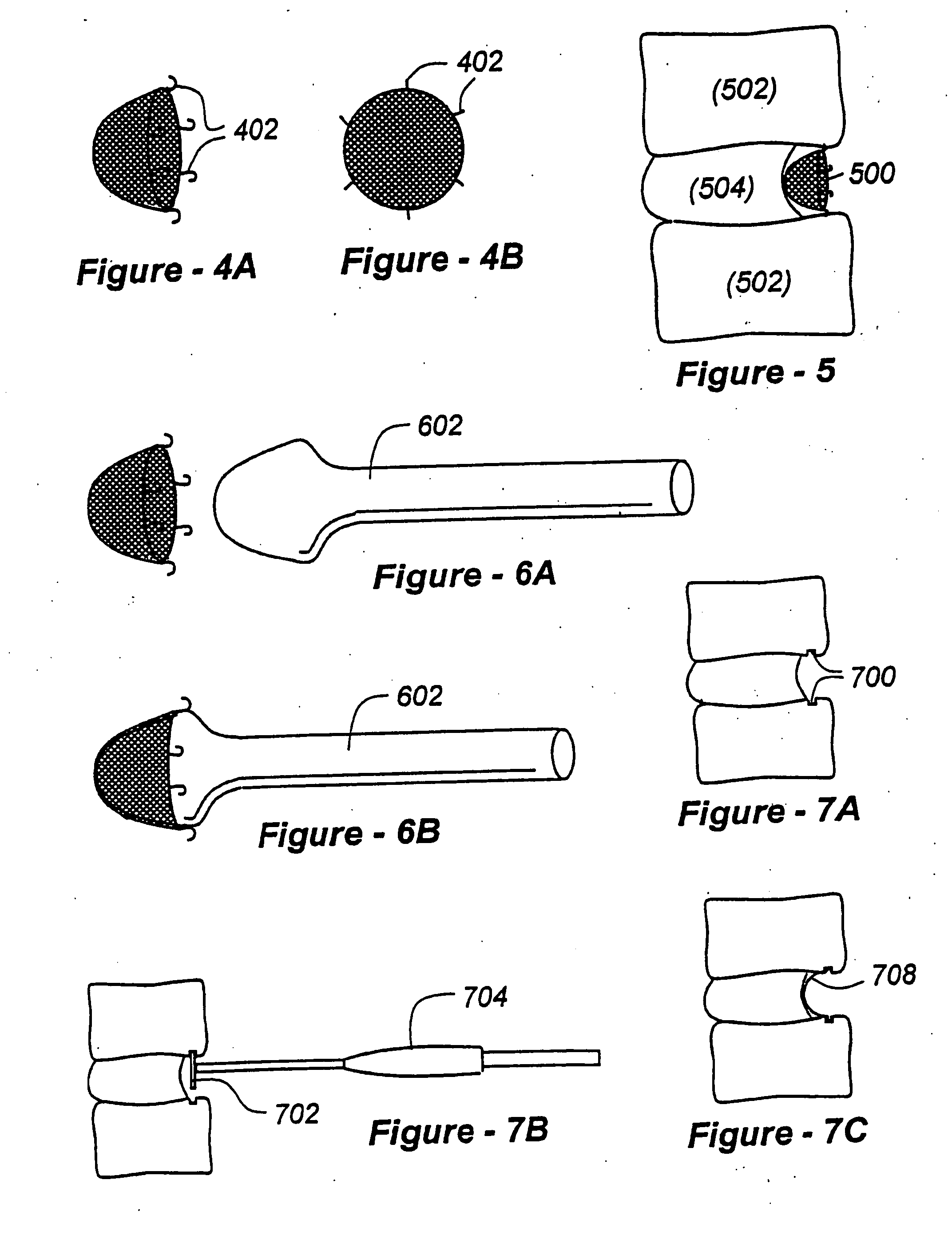 Methods and apparatus for treating disc herniation and preventing the extrusion of interbody bone graft