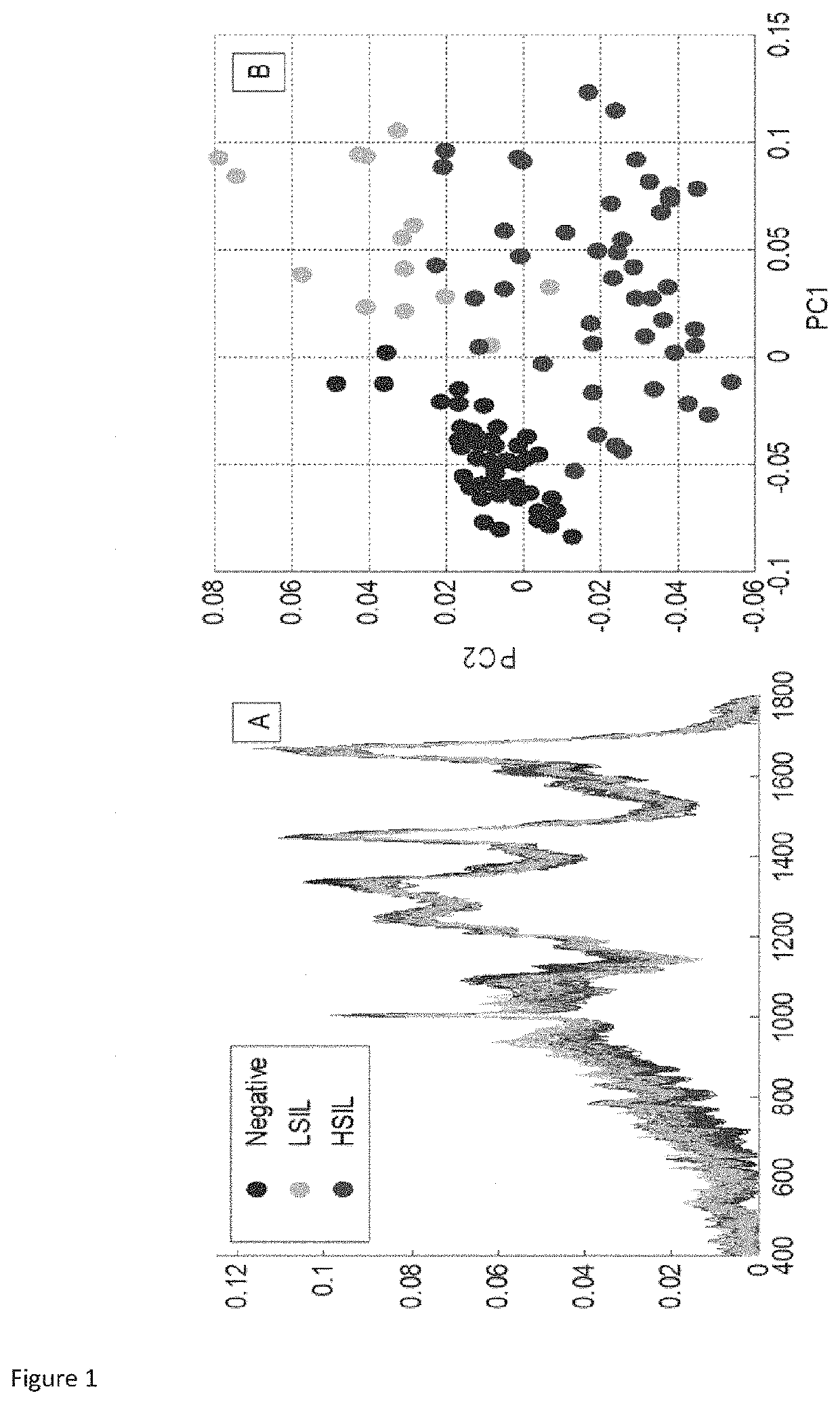 A method for identification of low grade cervical cytology cases likely to progress to high grade/cancer