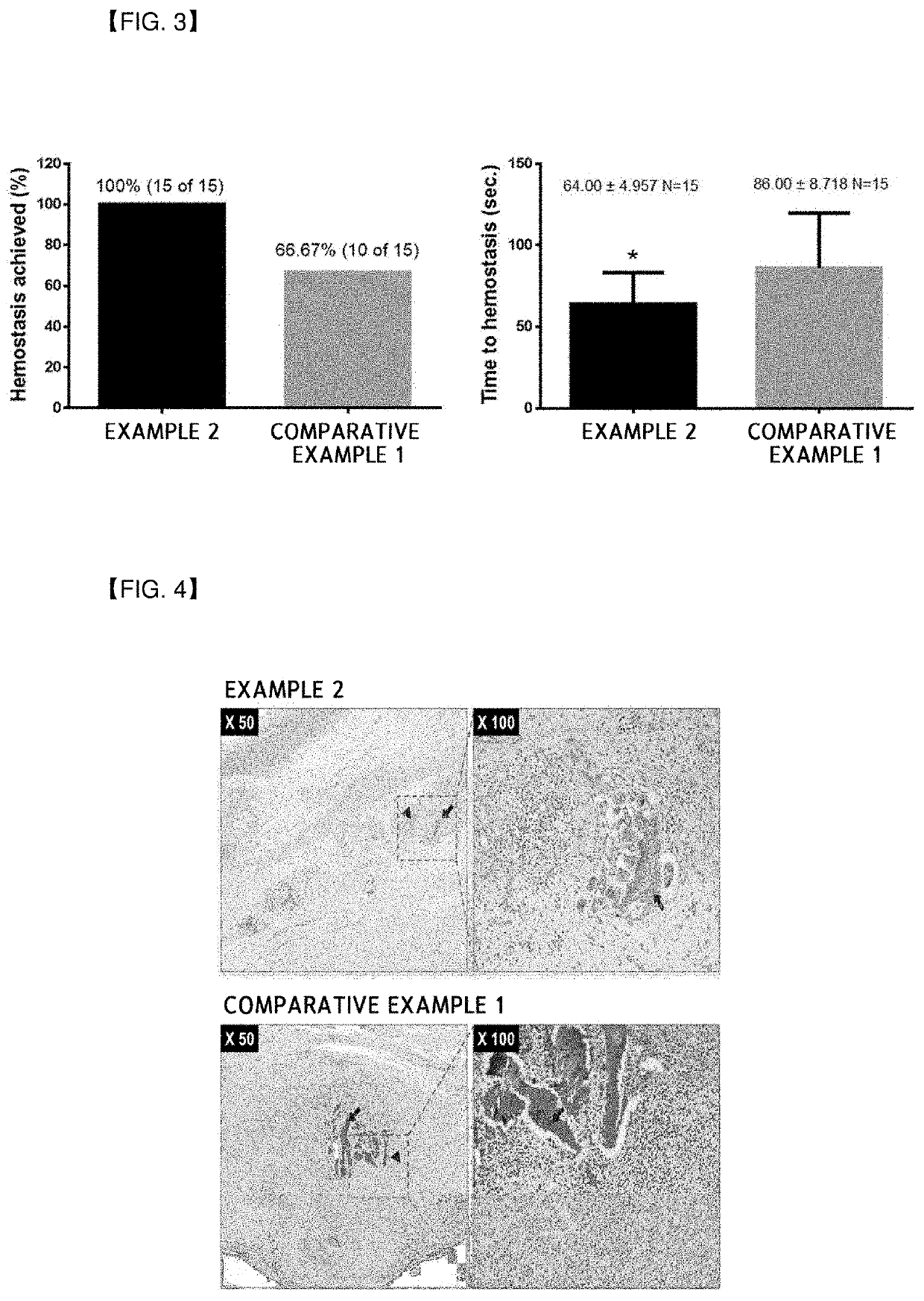 Composition for hemostasis and container comprising same