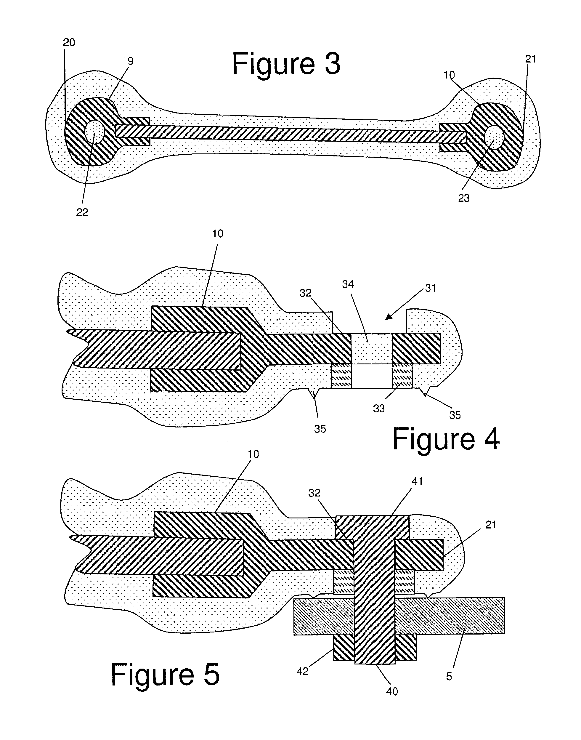 Bonding lead