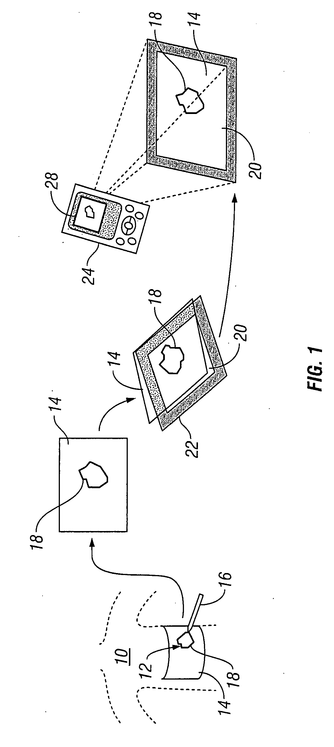 Systems and methods for wound area management