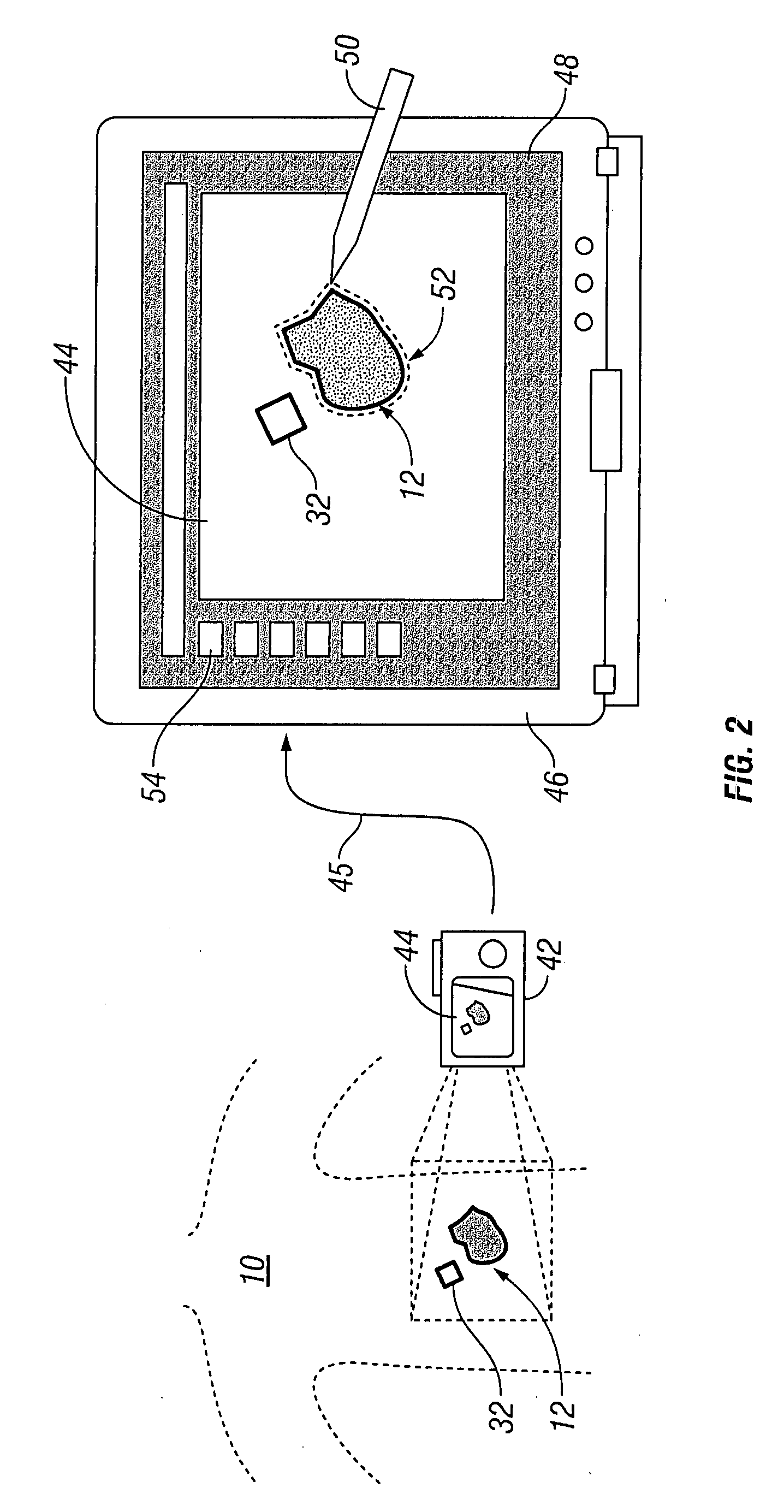 Systems and methods for wound area management