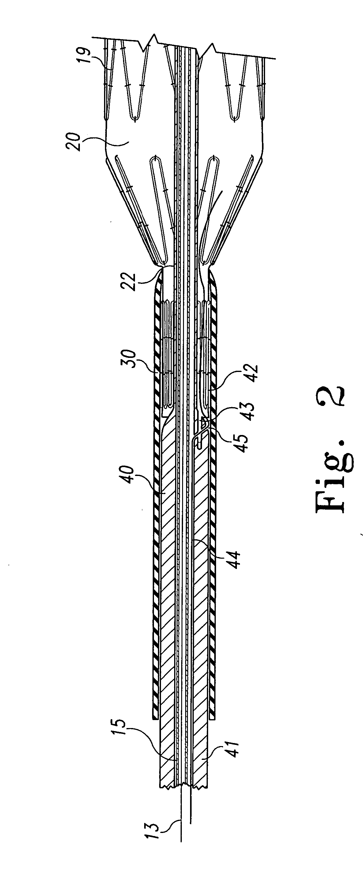 Prosthesis deployment system retention device