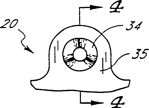 Cathether securement device