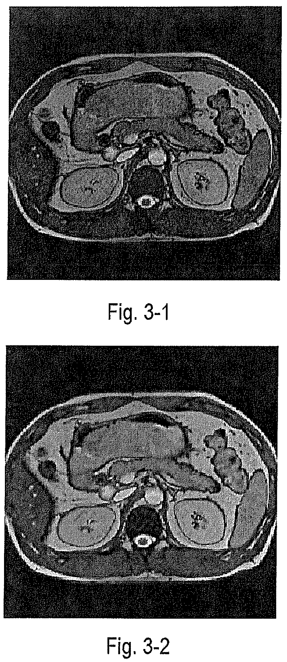 Method and apparatus for magnetic resonance imaging preview and establishing an MR model for the preview