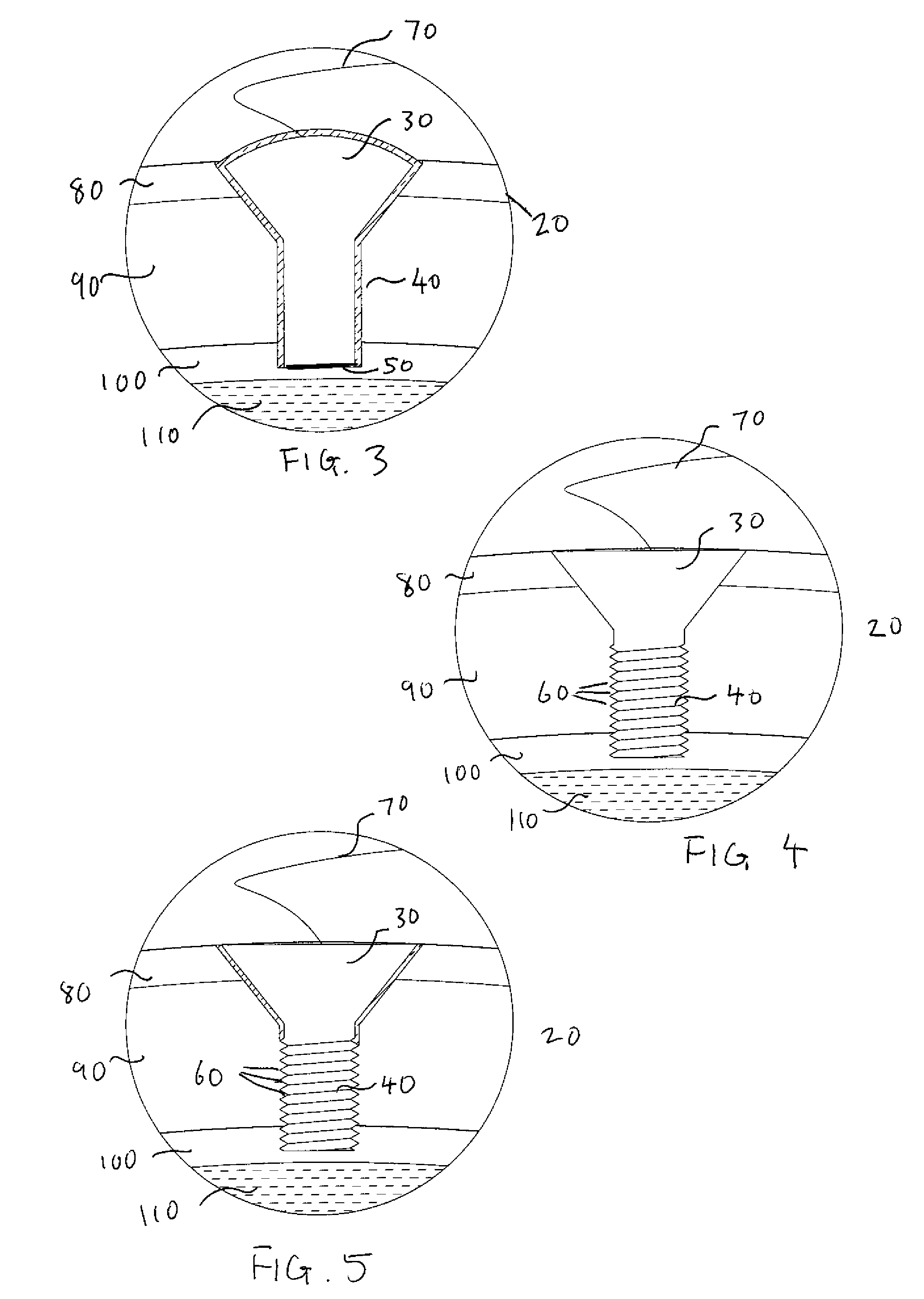 Methods and Systems for Using Intracranial Electrodes