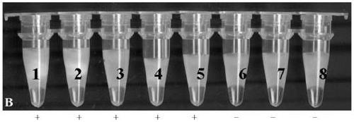 Lamp kit for detecting vanb gene and its special primers