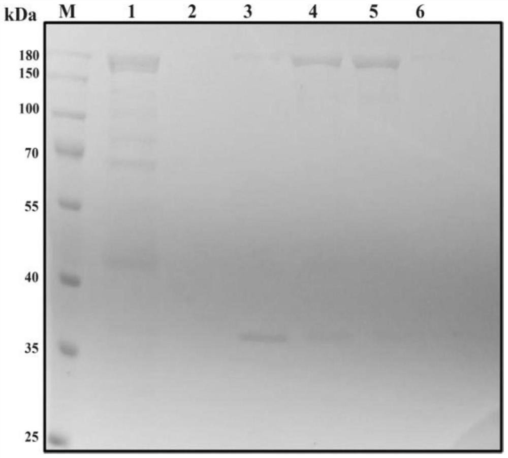 Kit and method for visually detecting trichomonas vaginalis based on RPA-CRISPR-Cas12a system