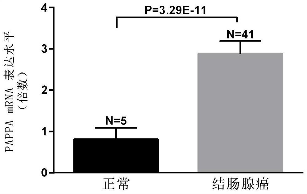 Biomarkers for the detection of colorectal cancer and their applications