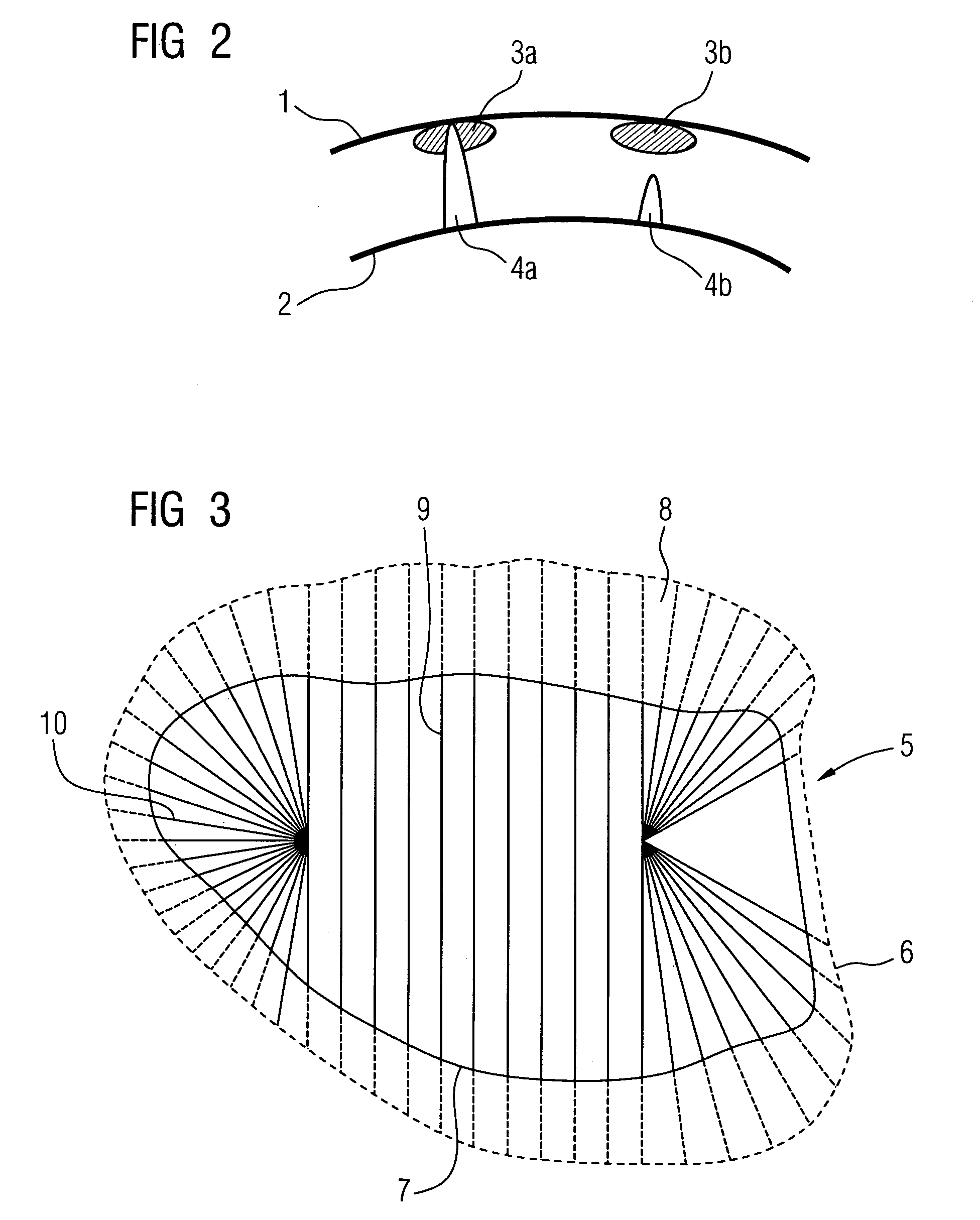 Method for determining an optimal output of an ablation catheter for a myocardial ablation in a patient and associated medical apparatus