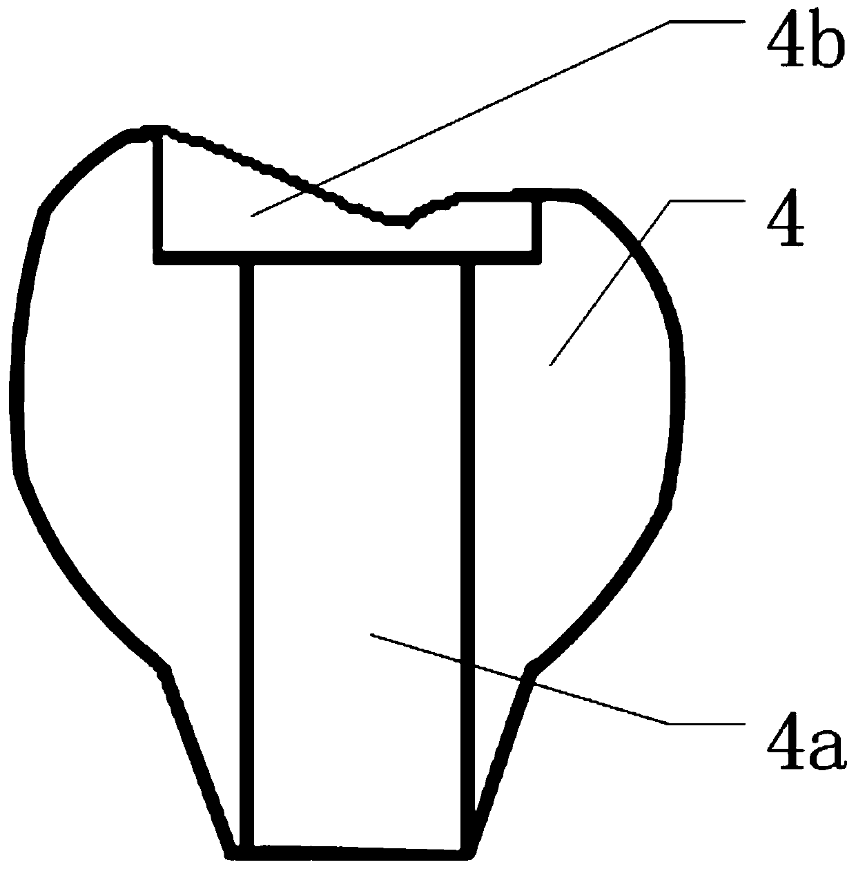 Digital design method for closing tooth implantation upper repairing screw holes through preformed inlay