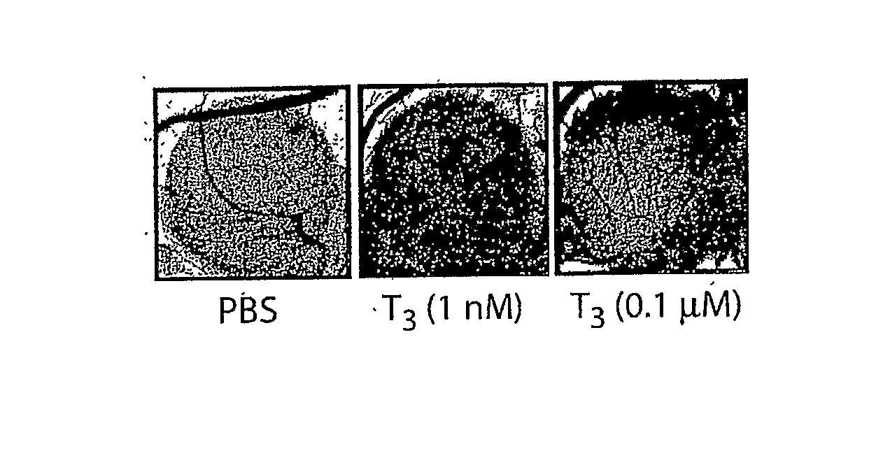 Thyroid Hormone Analogs and Methods of Use